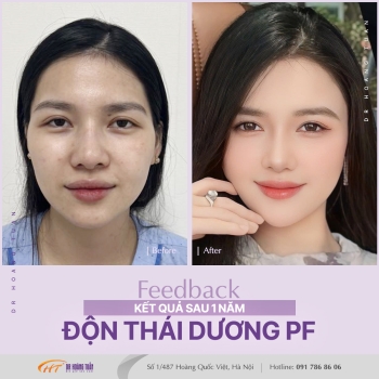 ĐỘN THÁI DƯƠNG
