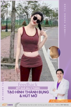 HÚT MỠ