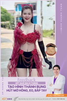 HÚT MỠ
