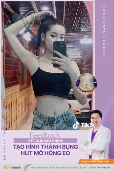 HÚT MỠ