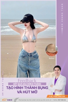 HÚT MỠ