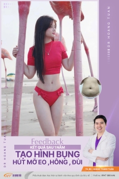 HÚT MỠ