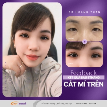 THẨM MỸ MẮT