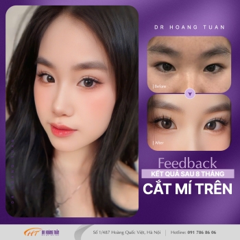 THẨM MỸ MẮT