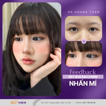 THẨM MỸ MẮT