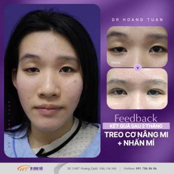 THẨM MỸ MẮT