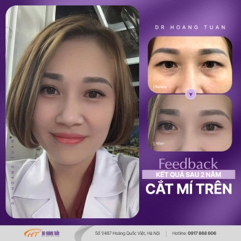 THẨM MỸ MẮT