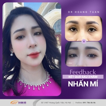 THẨM MỸ MẮT