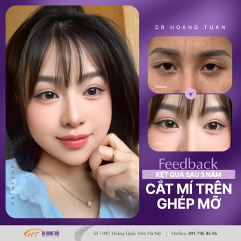 THẨM MỸ MẮT