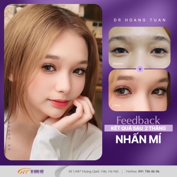 THẨM MỸ MẮT