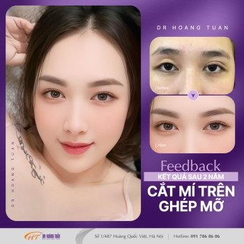 THẨM MỸ MẮT