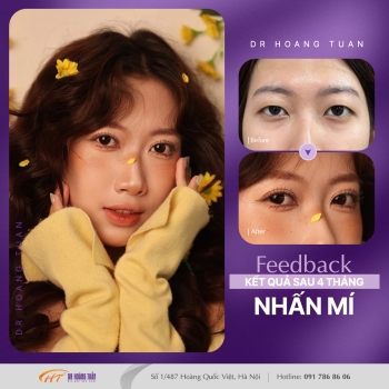 THẨM MỸ MẮT