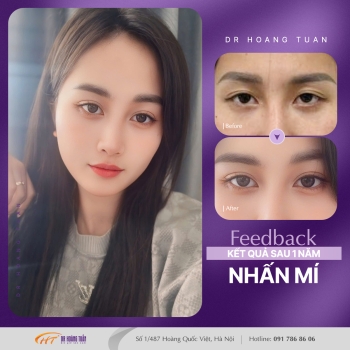THẨM MỸ MẮT