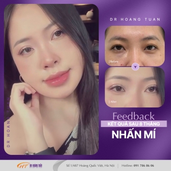 THẨM MỸ MẮT