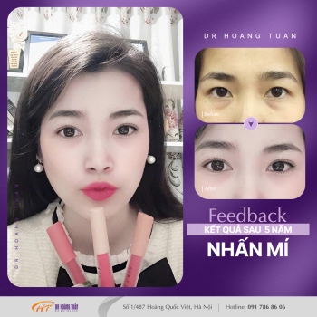 THẨM MỸ MẮT