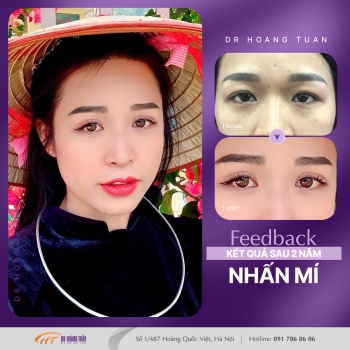 THẨM MỸ MẮT