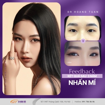 THẨM MỸ MẮT