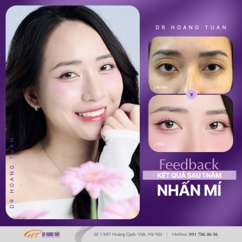 THẨM MỸ MẮT