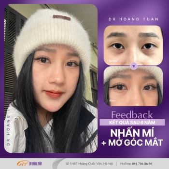 THẨM MỸ MẮT