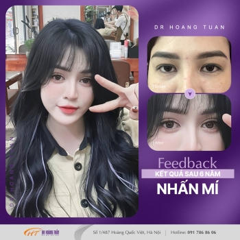 THẨM MỸ MẮT