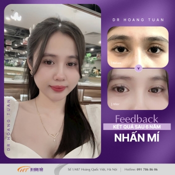 THẨM MỸ MẮT
