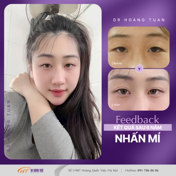 THẨM MỸ MẮT
