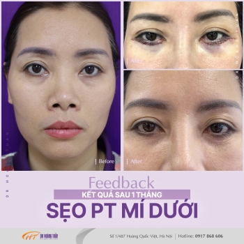 THẨM MỸ MẮT