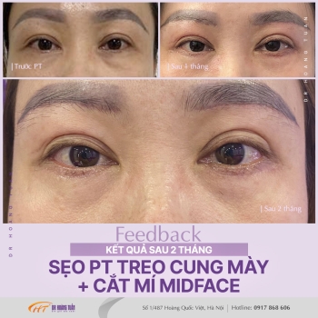 THẨM MỸ MẮT