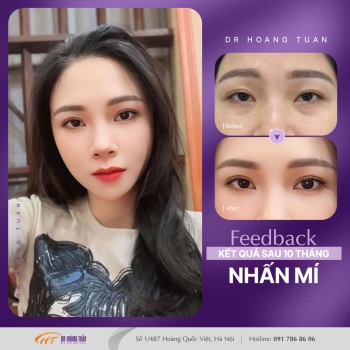 THẨM MỸ MẮT