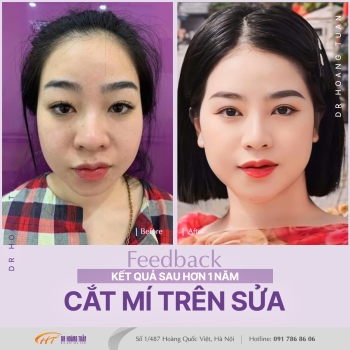 THẨM MỸ MẮT