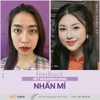 THẨM MỸ MẮT