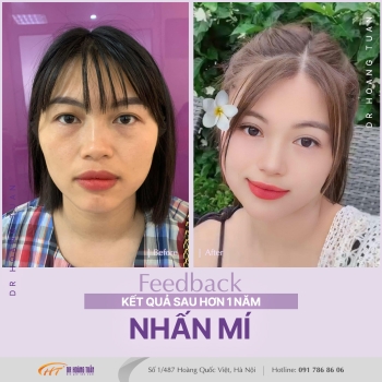 THẨM MỸ MẮT