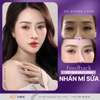 THẨM MỸ MẮT