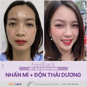 THẨM MỸ MẮT