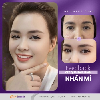 THẨM MỸ MẮT
