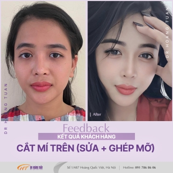THẨM MỸ MẮT