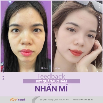THẨM MỸ MẮT