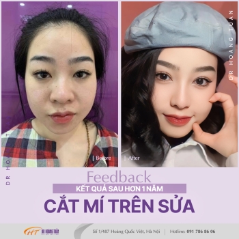THẨM MỸ MẮT