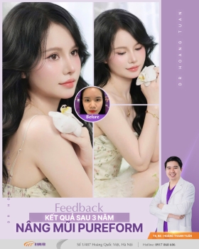 THẨM MỸ MŨI