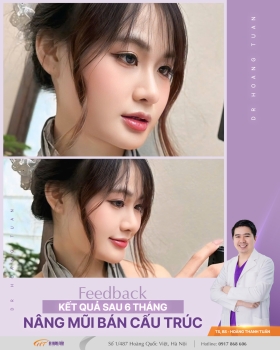 THẨM MỸ MŨI