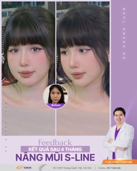 THẨM MỸ MŨI