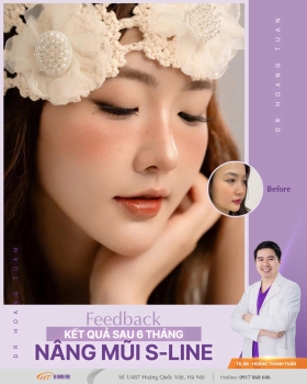 THẨM MỸ MŨI