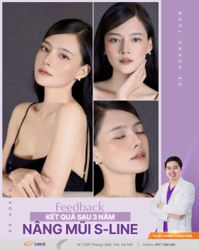 THẨM MỸ MŨI