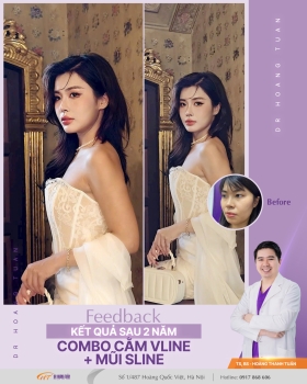 THẨM MỸ MŨI