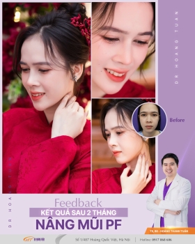 THẨM MỸ MŨI