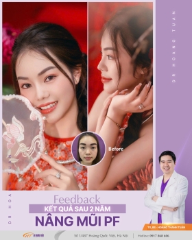 THẨM MỸ MŨI