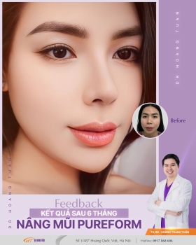 THẨM MỸ MŨI