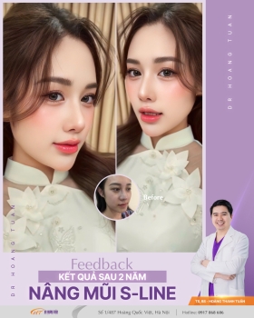 THẨM MỸ MŨI