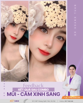 THẨM MỸ MŨI