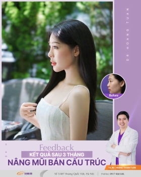THẨM MỸ MŨI